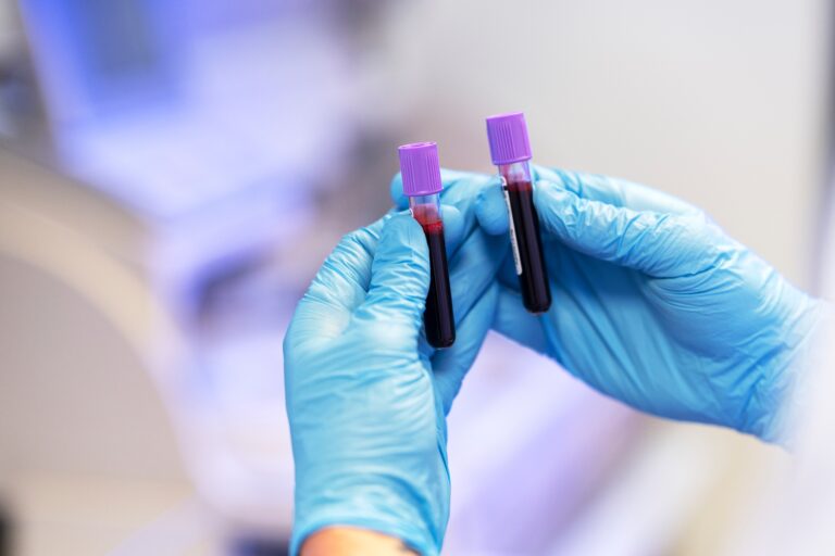<p>Liquid Biopsy to test for cancer</p>
