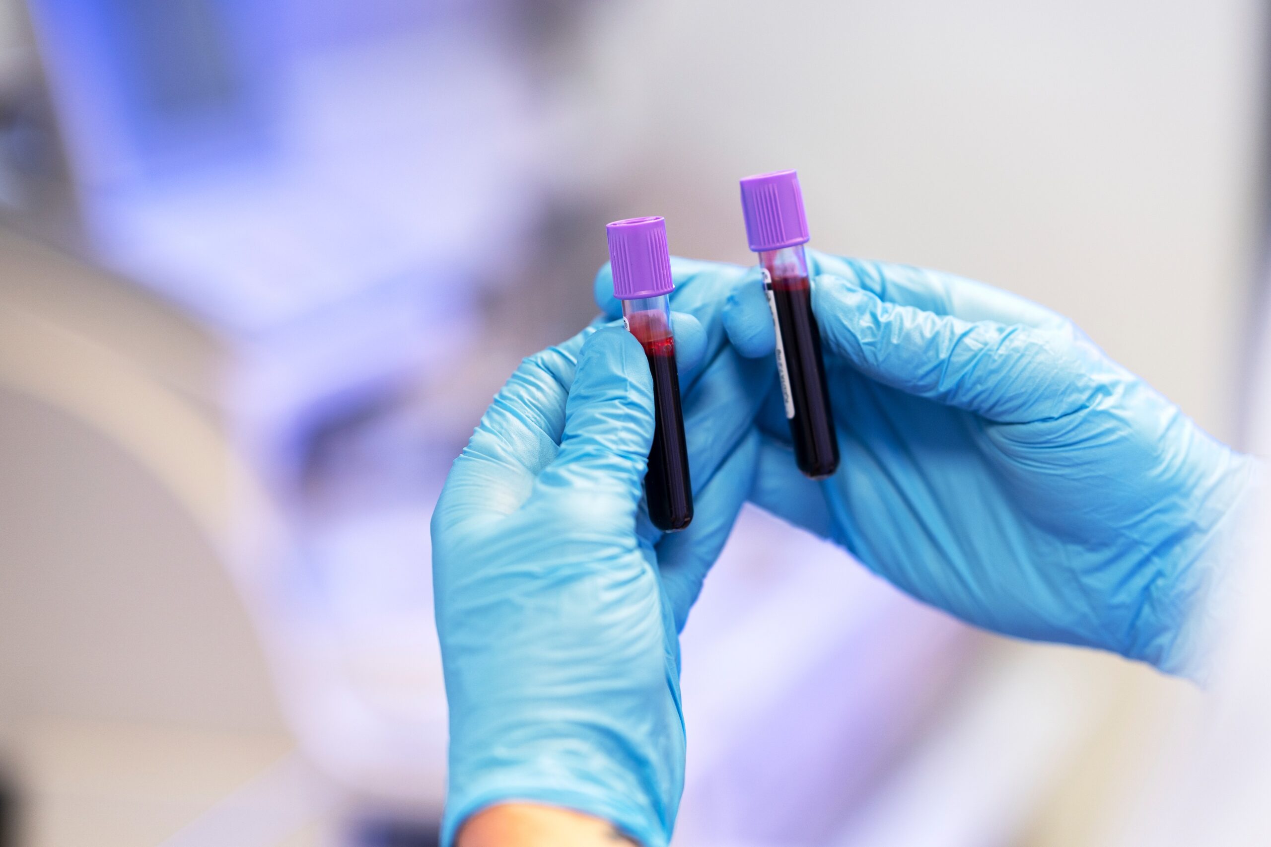 Liquid Biopsies: Revolutionizing Early Detection and Monitoring of Cancer