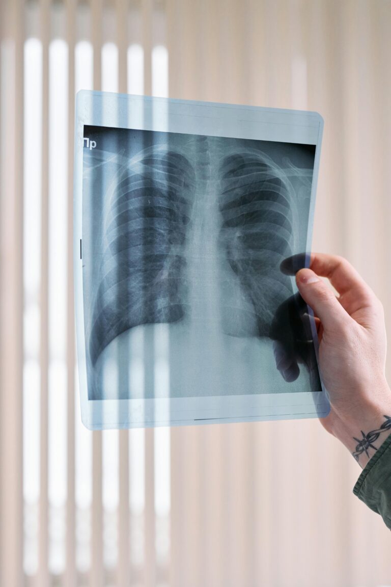 <p>mind-body tools for lung cancer patients </p>
<p>mind-body tools for lung cancer patients </p>