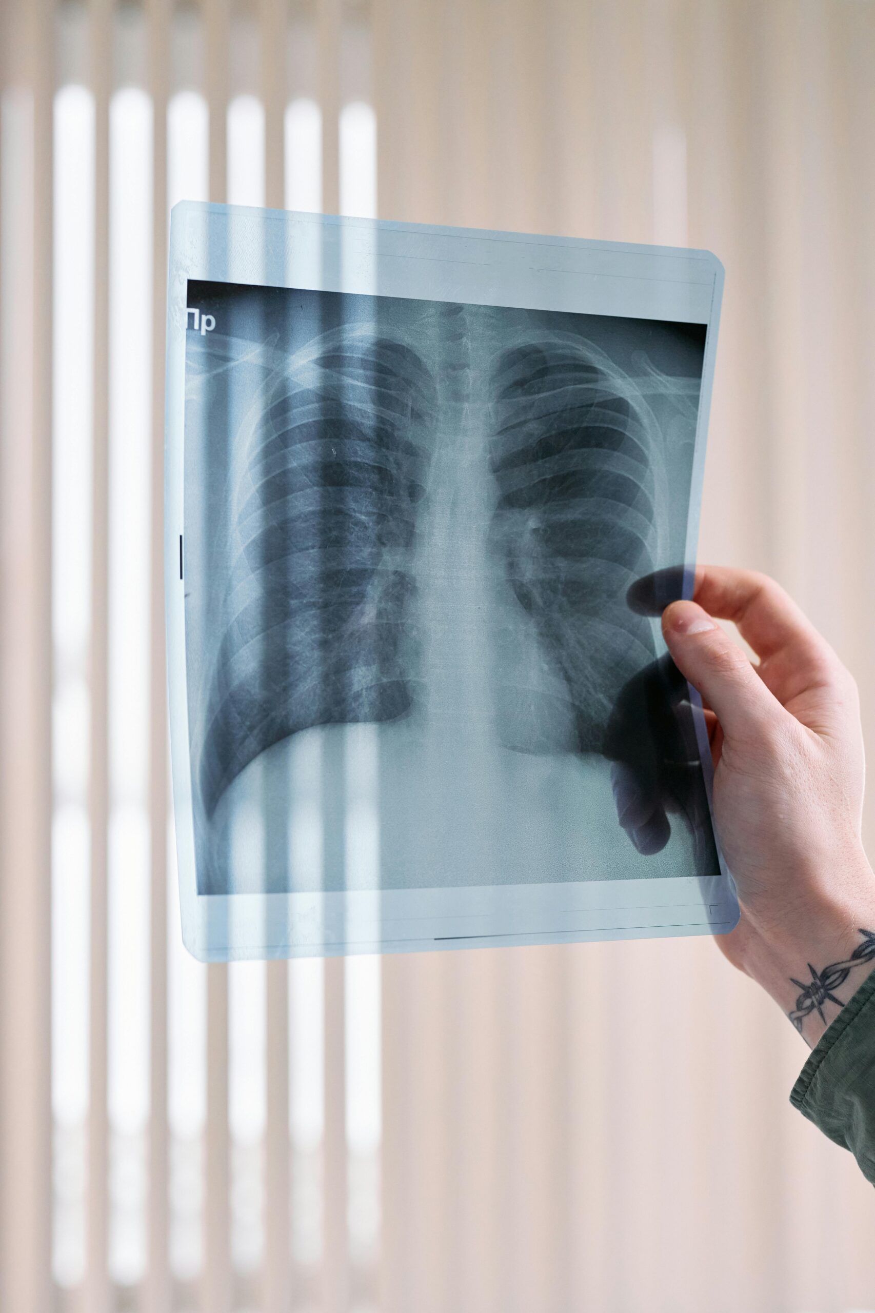 Tools for Lung Cancer Patients: Easing Breathlessness and Anxiety