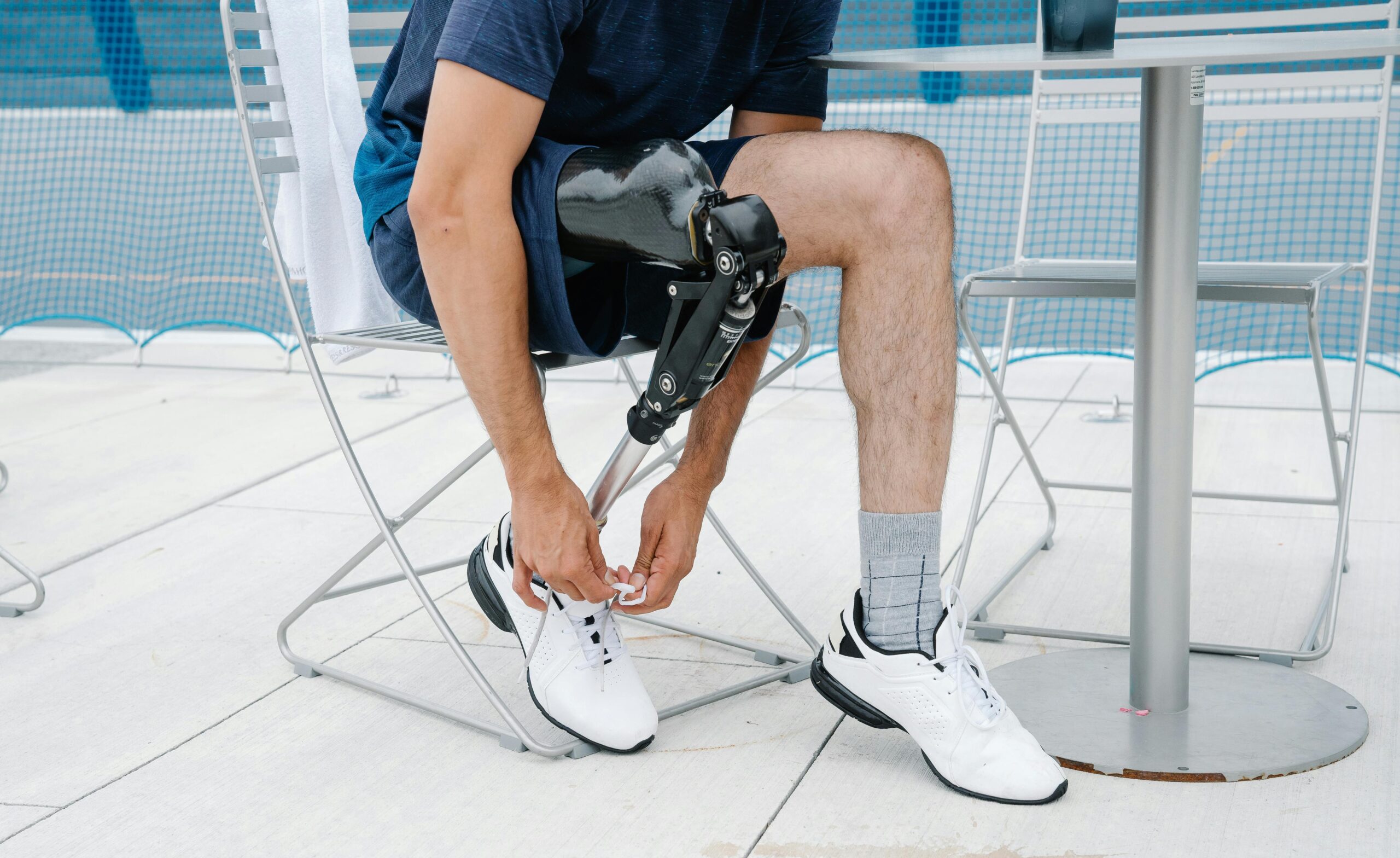 How Prosthetics Can Improve Quality of Life for Patients Who Have Lost Limbs